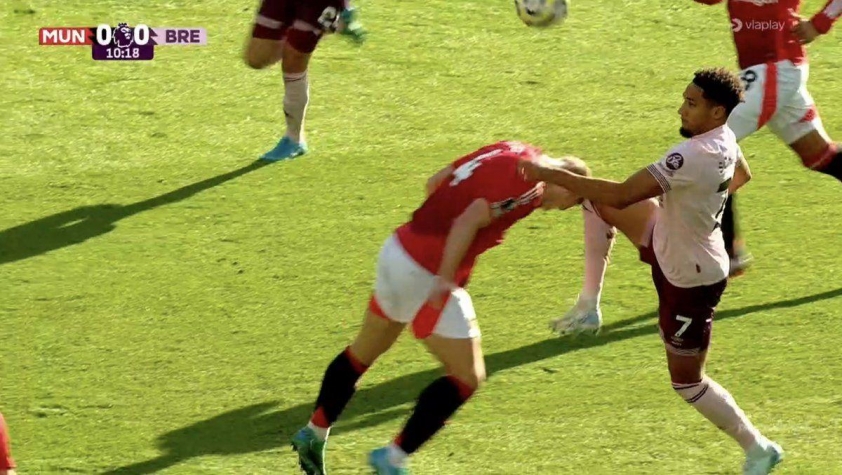 De Ligt Chịu Vết Thương Đẫm Máu Sau Va Chạm Thô Bạo Trong Trận Gặp Brentford