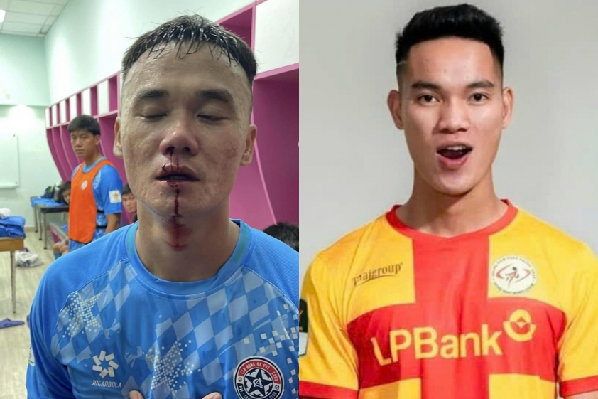 Vụ ẩu đả đổ máu gây rúng động giải hạng Nhất Thực hư lời qua tiếng lại