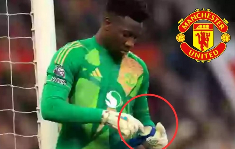 Andre Onana: Vaseline, Sai Lầm Và Áp Lực Tại Man Utd