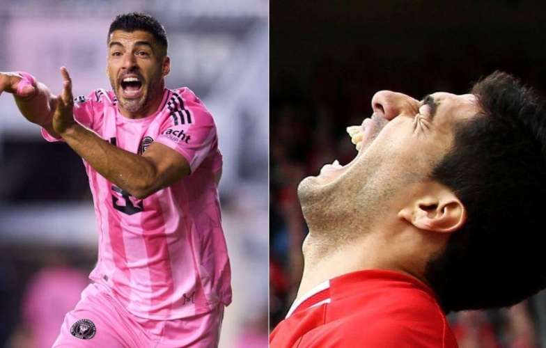 Suarez suýt nữa lại cắn người, nhưng lần này là đồng đội!