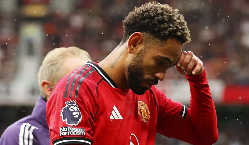 Cunha rời sân giữa trận đấu với Burnley