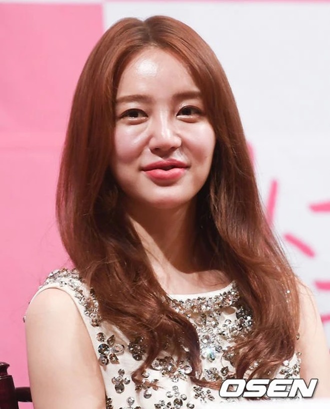 Di chứng dao kéo trên gương mặt Yoon Eun Hye