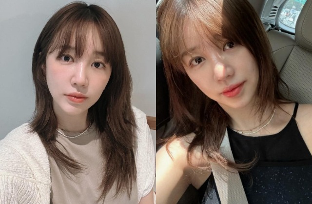 Gương mặt cân đối hơn của Yoon Eun Hye hiện tại