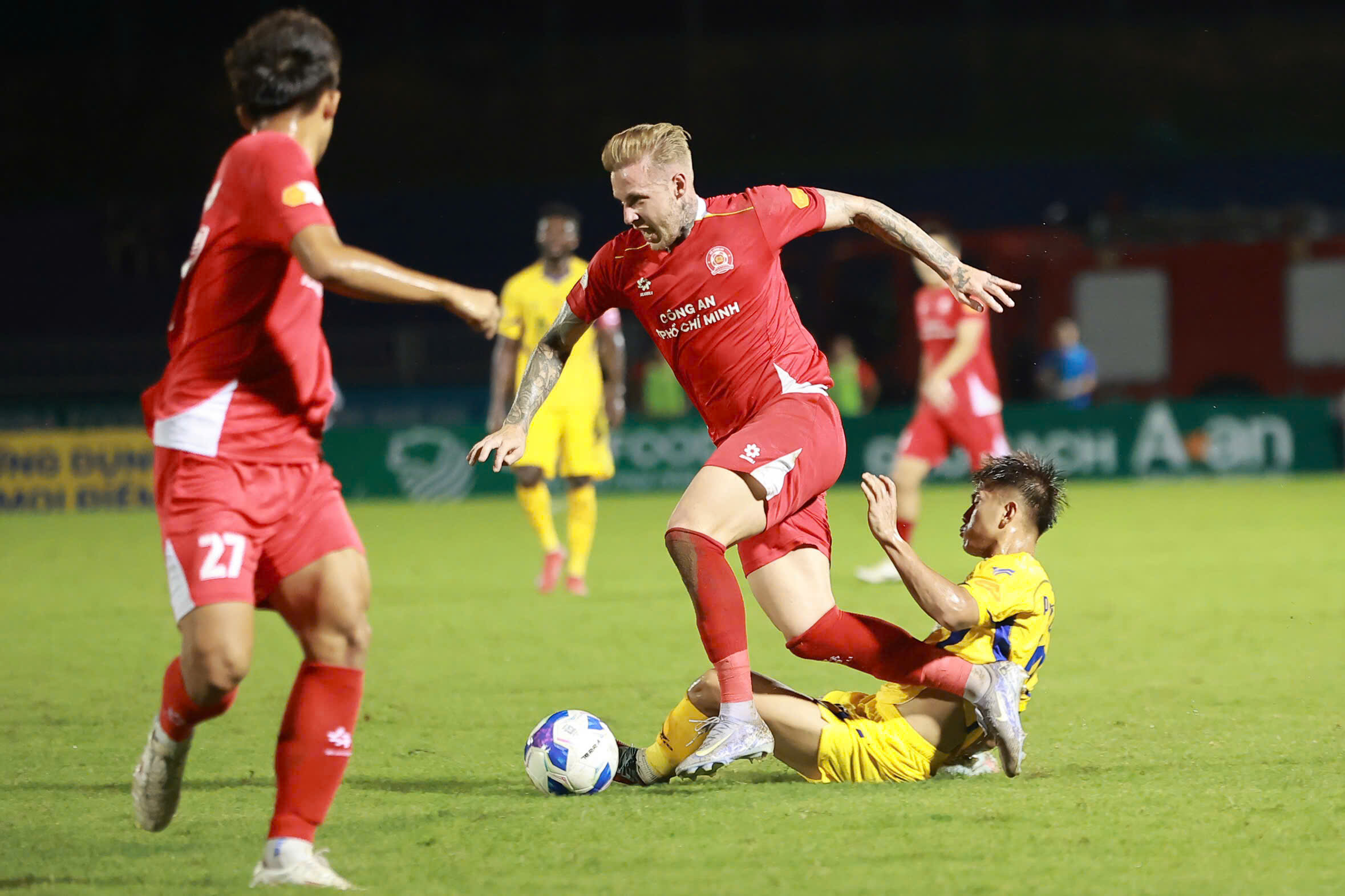 Ngoại binh chấn thương hàng loạt đang là vấn đề đáng lo với CLB Công an TPHCM