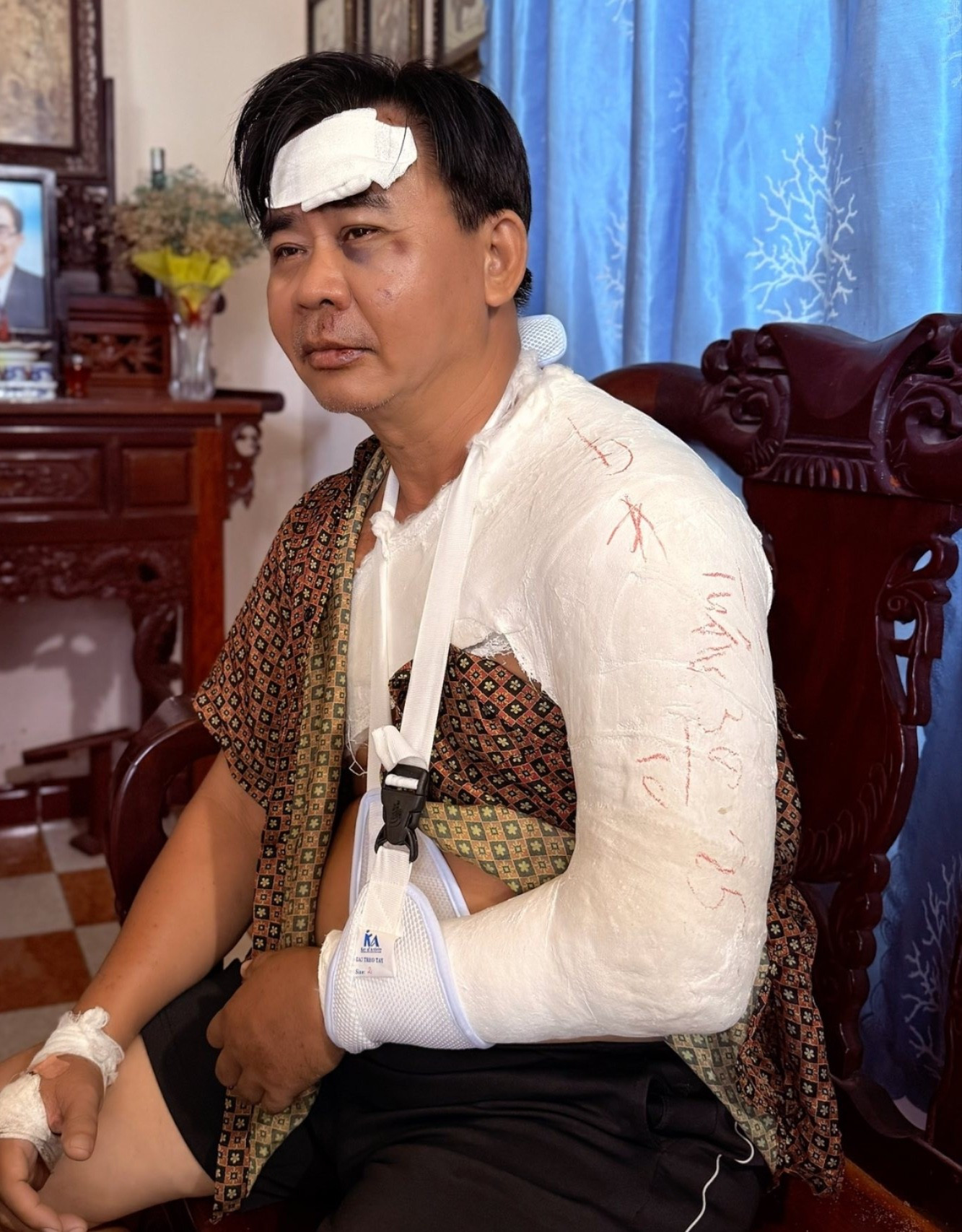 Nghệ sĩ Chánh Thuận sau tai nạn xe