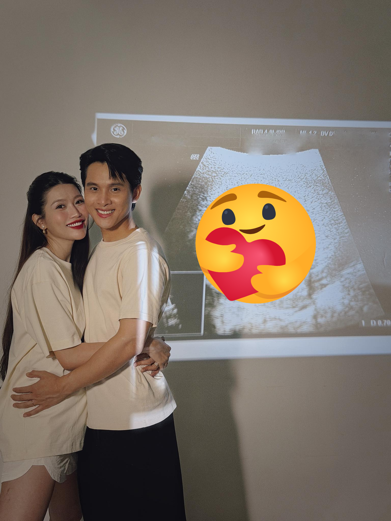 Chế Nguyễn Quỳnh Châu mang thai con đầu lòng sau hơn 1 tháng đám cưới- Ảnh 1. Chế Nguyễn Quỳnh Châu mang thai con đầu lòng sau hơn 1 tháng đám cưới- Ảnh 1.