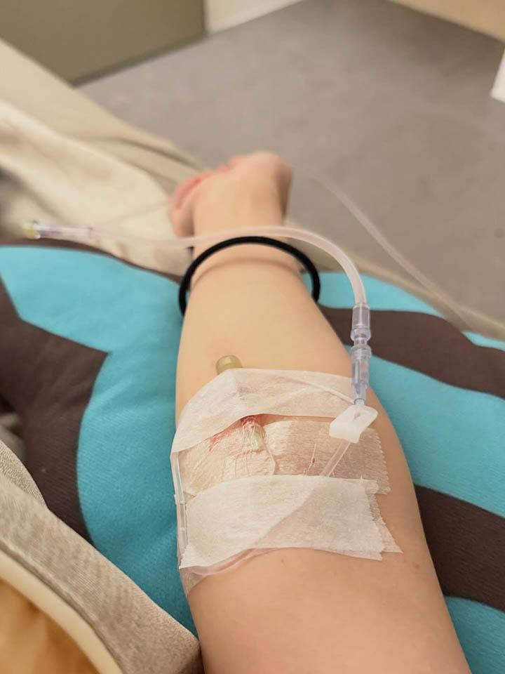 Hình ảnh coser truyền dịch trong bệnh viện
